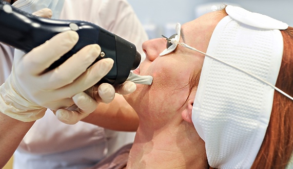 Laserowe usuwanie blizn potrądzikowych laserem frakcyjnym CO₂ i terapie łączone Laserowe usuwanie blizn potrądzikowych laserem frakcyjnym CO₂ i terapie łączone