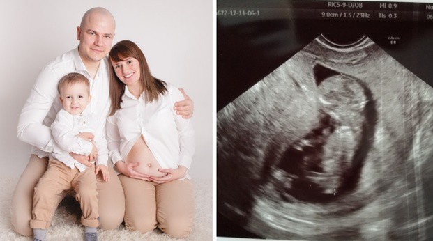 Elbląg, Zdjęcie pochodzi ze strony akcji zbiórki na rzecz Kubusia