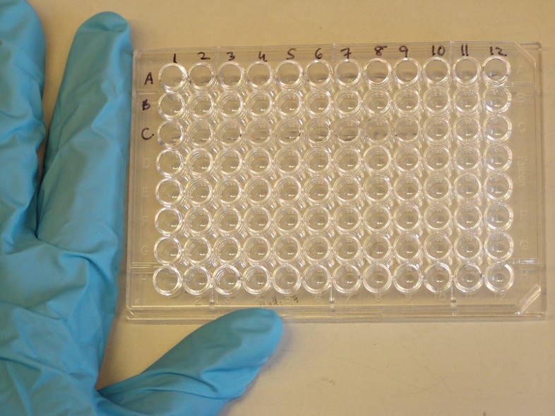 Elbląg, In vitro budżetu obywatelskiego nie wygra Elbląg, In vitro budżetu obywatelskiego nie wygra