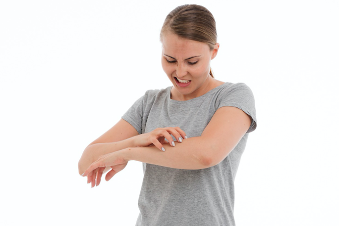 Bezpłatne konsultacje dermatologiczne dla pacjentów z pokrzywką idiopatyczną Bezpłatne konsultacje dermatologiczne dla pacjentów z pokrzywką idiopatyczną