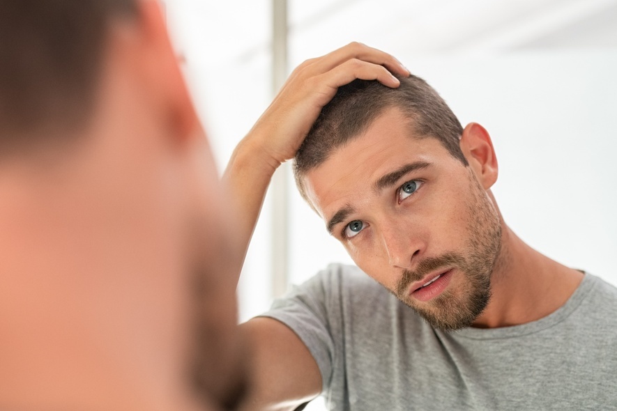 Jak poradzić sobie z łysieniem androgenowym?