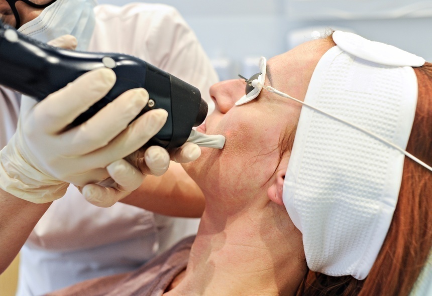 Laseroterapia w dermatologii estetycznej w gabinecie Medesta Laseroterapia w dermatologii estetycznej w gabinecie Medesta