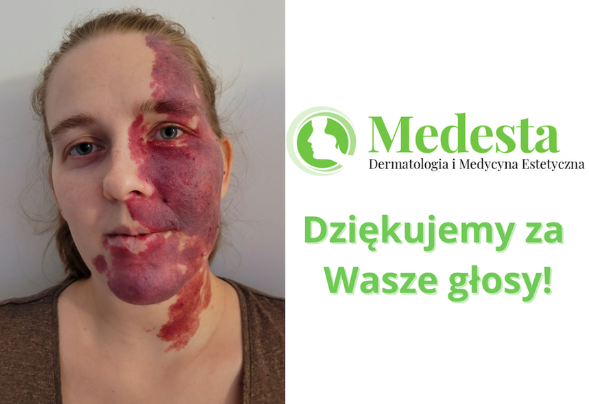 Laureatka konkursu z Medestą: "Jestem bardzo wzruszona" Laureatka konkursu z Medestą: "Jestem bardzo wzruszona"