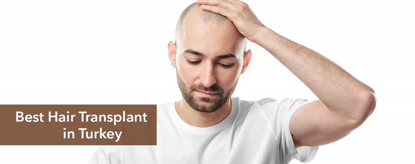 Why Capilclinic Is One of the Best Hair Transplant Clinics in Turkey? Why Capilclinic Is One of the Best Hair Transplant Clinics in Turkey?