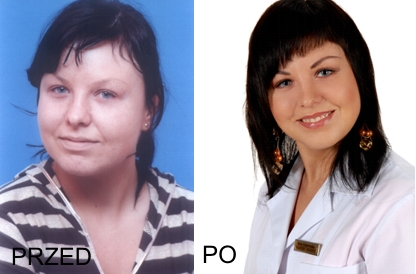 Elbląg, Pani Ula przed i po wykonaniu zabiegu trwałego makijażu. Elbląg, Pani Ula przed i po wykonaniu zabiegu trwałego makijażu.