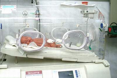 Elbląg, Oddział intensywnej terapii noworodków w szpitalu wojewódzkim otrzymał nowoczesny inkubator