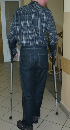 Elbląg, 37-letni Andrzej J. poruszał się o kulach w zależności od celu, jaki chciał osiągnąć np. wbudzić litość