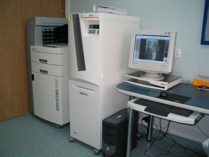 Elbląg, Zdjęcie rentgenowskie wykonane nowym aparatem można dowolnie przetwarzać w komputerze (fotka nadesłana)