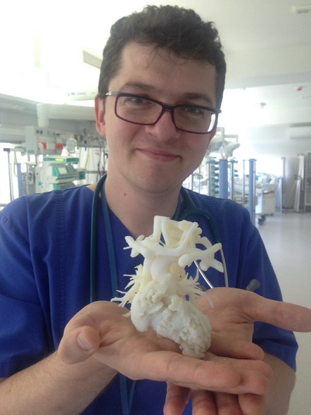 Elbląg, Lekarz z Gdańska prezentuje model serca dziecka w 3D