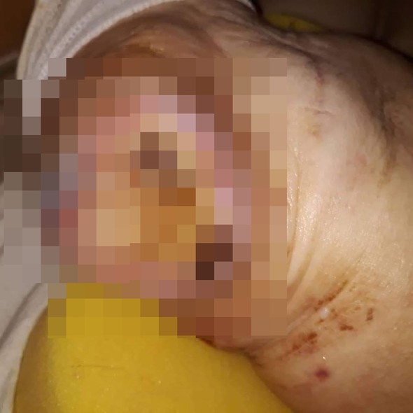 Elbląg, Czytelniczka: Tak szpital potraktował mamę Elbląg, Czytelniczka: Tak szpital potraktował mamę