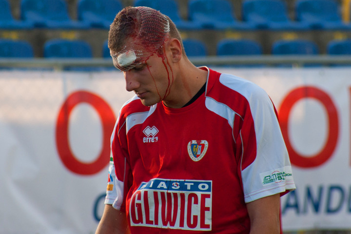 Krwawy sport. Kontuzjowany Mateusz Bodzich ( Piast Gliwice ) podczas meczu z Olimpią Elbląg