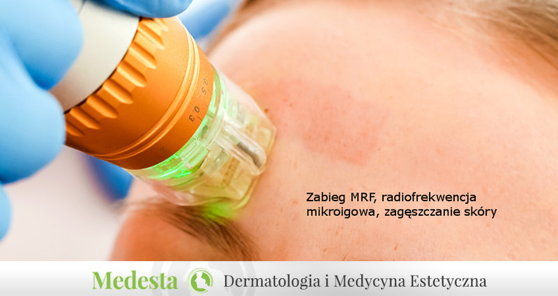 Współpraca kosmetologa i dermatologa estetycznego. Bony upominkowe zdjęcie nr 165994