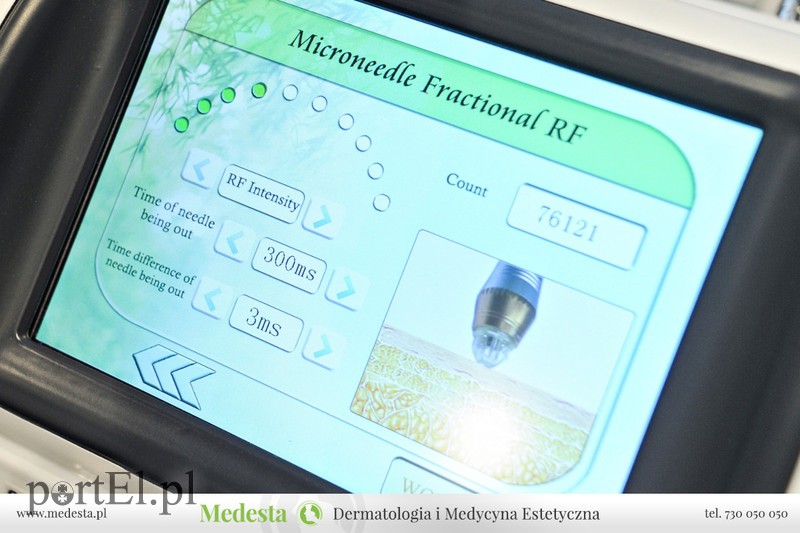 Kompleksowa terapia blizn i rozstępów w Klinice Medesta zdjęcie nr 171677