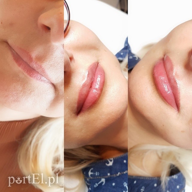 Zamiast botoksu i wypełniaczy wypróbuj autorską metodę pigmentacji ust w salonie Aesthetica Elbląg zdjęcie nr 225644