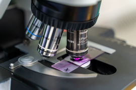 “Antybiotykoterapia musi być precyzyjna”