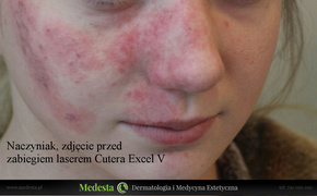 Rzeczywiste rezultaty zabiegów w Klinice Medesta Rzeczywiste rezultaty zabiegów w Klinice Medesta