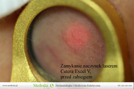 Rzeczywiste rezultaty zabiegów w Klinice Medesta