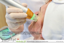 Kompleksowa terapia blizn i rozstępów w Klinice Medesta