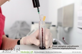 Kompleksowa terapia blizn i rozstępów w Klinice Medesta