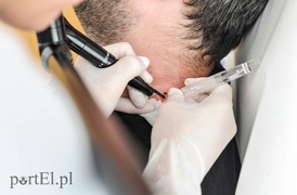 Tu nie trzeba używać skalpela